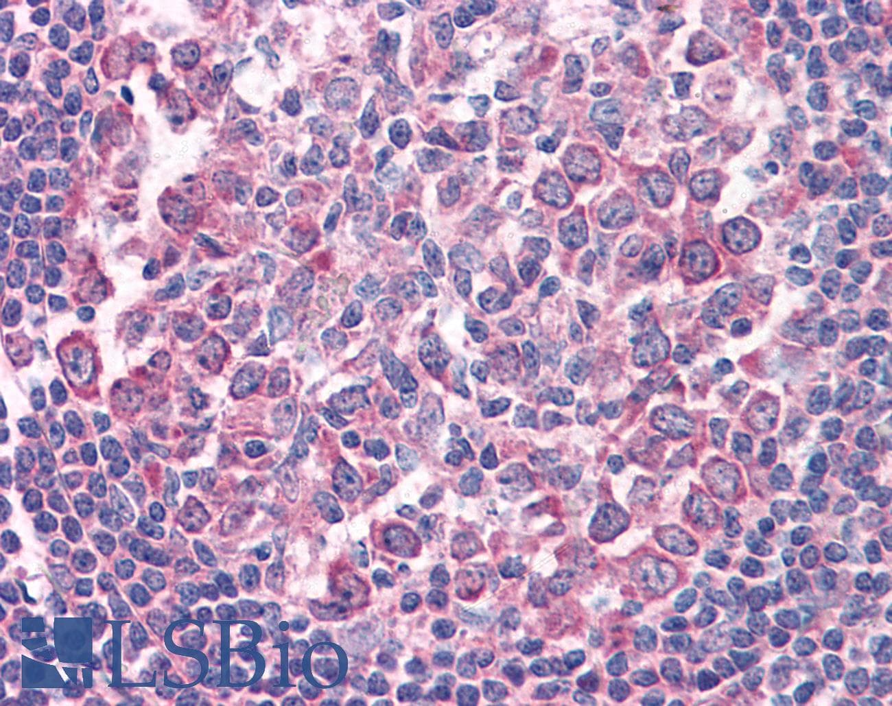 IHC-plus™ CD95 / FAS Antibody (aa224-237)