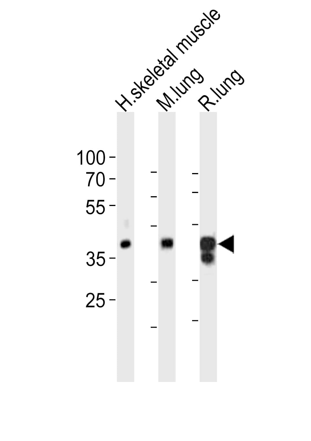 LMCD1 Antibody (aa316-350)