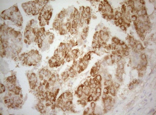 TWF1 / PTK9 Antibody (aa140-384, clone OTI5C12)