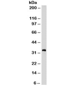 CD99 Antibody (clone HO36-1.1)