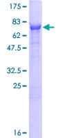 Human CNDP2 Protein (Recombinant GST)