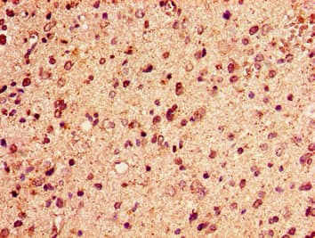 HIST1H2AI Antibody