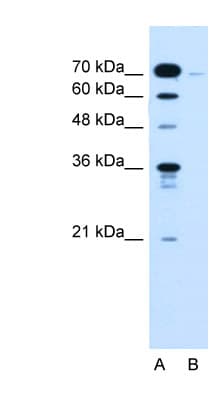 Polyclonal Rabbit anti-Human KLHL31 Antibody (Biotin, aa501-550, IHC, WB)