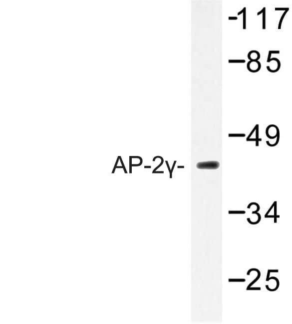 TFAP2C / AP2 Gamma Antibody (Ala436)