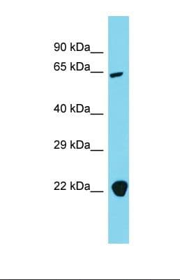 Polyclonal Rabbit anti-Human AP4B1 Antibody (aa580-629, WB)