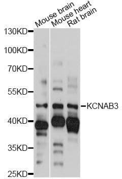 Polyclonal Rabbit anti-Human KCNAB3 Antibody (WB)