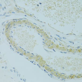 IFT57 / HIPPI Antibody