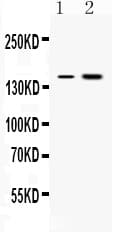 INSR / Insulin Receptor Antibody