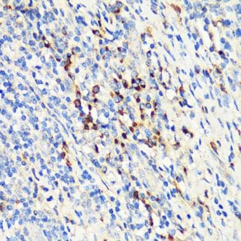 TNFSF11 / RANKL / TRANCE Antibody
