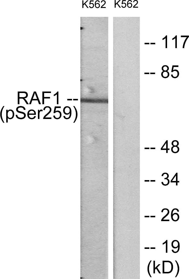 RAF1 / RAF Antibody (phospho-Ser259)