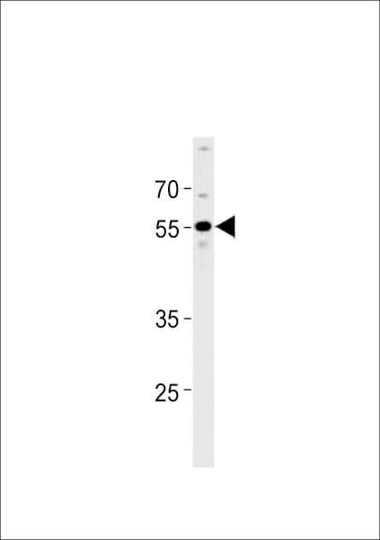 PPHLN1 Antibody (aa45-66)
