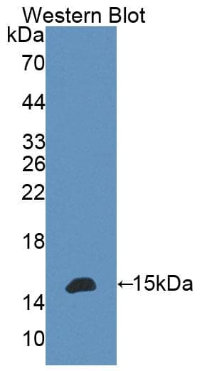 BTLA / CD272 Antibody (aa31-157, Biotin)