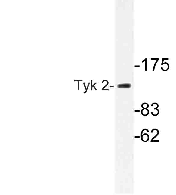 IHC-plus™ TYK2 Antibody (Val1048)