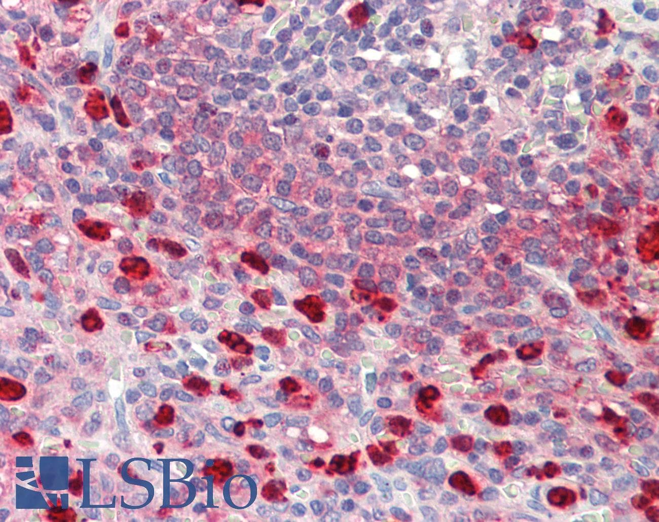 IHC-plus™ CDKN2D / p19 INK4d Antibody (aa15-43)