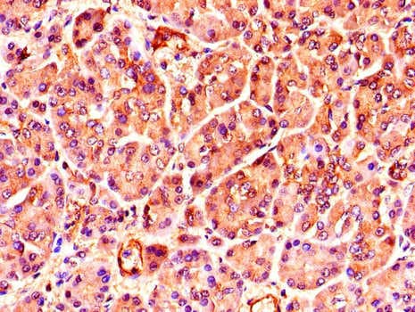 TNRC6C Antibody