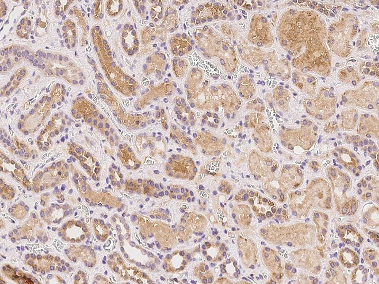 Polyclonal Rabbit anti-Human TMEM52B / C12orf59 Antibody (IHC)