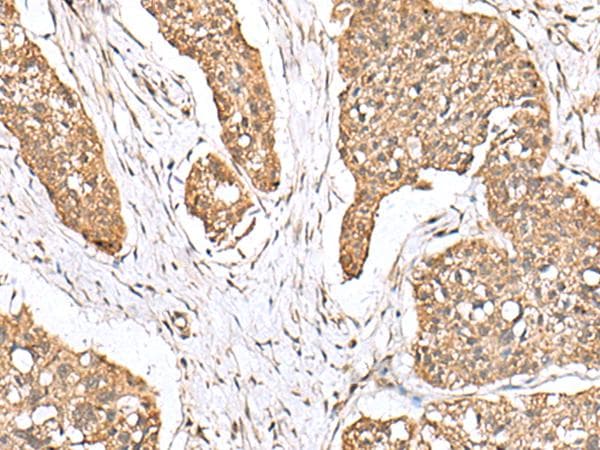 PLA2G2A / SPLA2 Antibody