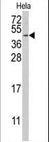 Polyclonal Rabbit anti-Human RFC5 Antibody (aa170-200, WB)