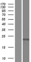 Human Cardiolipin Synthase / CRLS1 Protein (Over-Expression Lysate Myc-DDK (Flag))