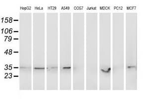 RDH14 Antibody (clone OTI6C3, Carrier-free)