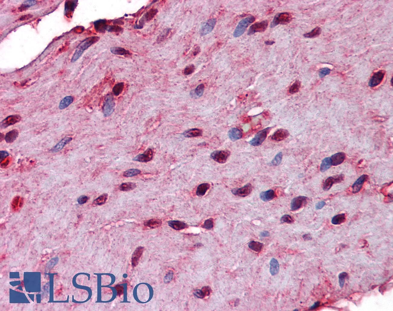 IHC-plus™ STI1 / STIP1 Antibody (clone 2E1)