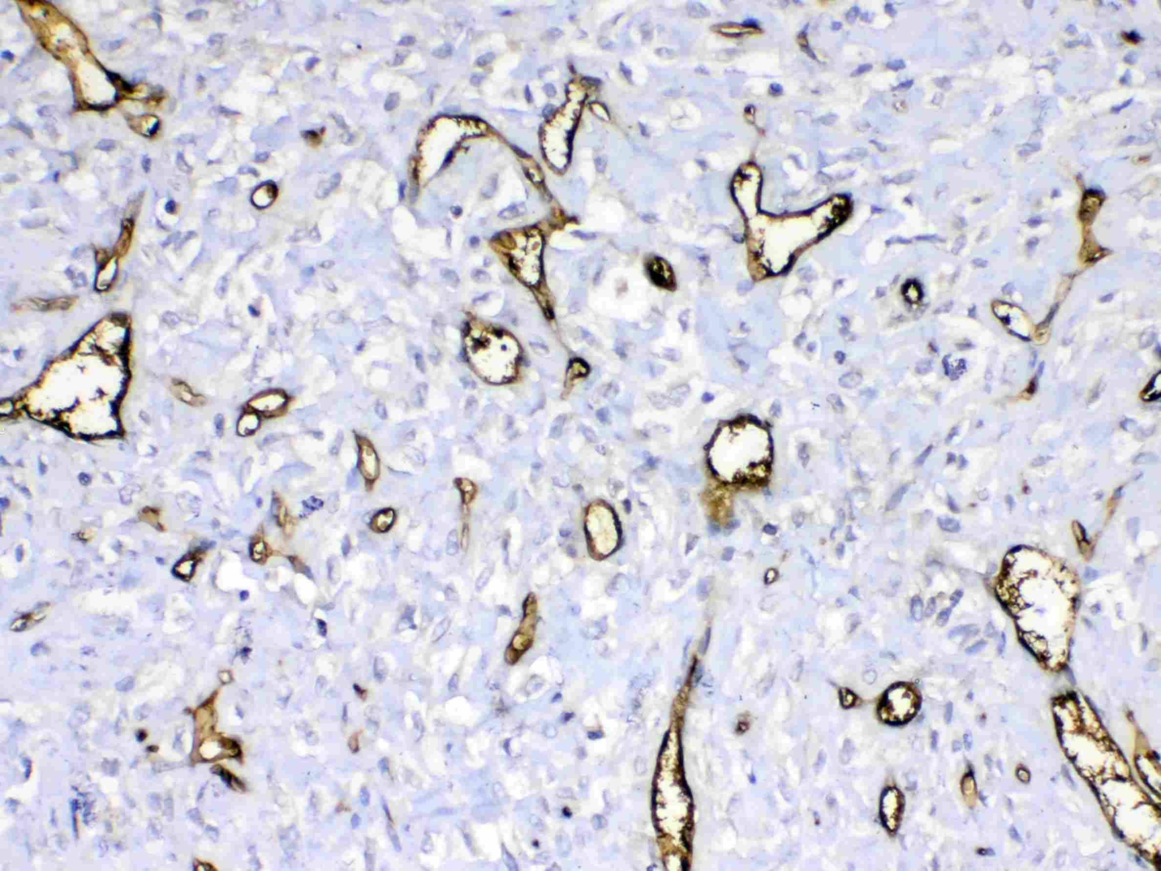 HBD / Hemoglobin Delta Antibody