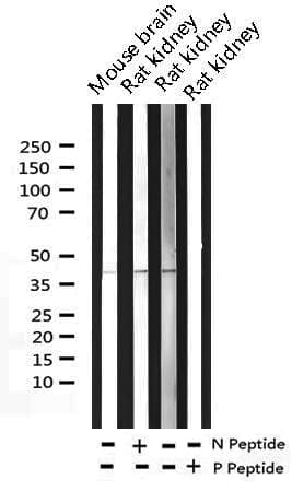 Polyclonal Rabbit anti-Human FOS / c-FOS Antibody (phospho-Ser362, IHC, IF, WB)