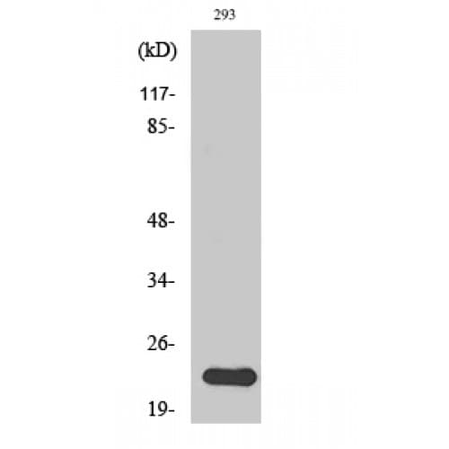 Ras (H, K, N) Antibody (10-90 aa, N-terminal)