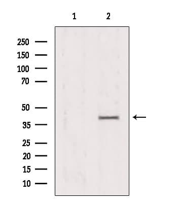 PRKAG1 / AMPK Gamma 1 Antibody