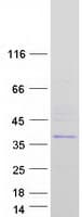 Human SPG21 / MAST Protein (Recombinant Myc-DDK (Flag))