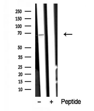 Polyclonal Rabbit anti-Human ARAF / ARAF1 / A-RAF Antibody (WB)