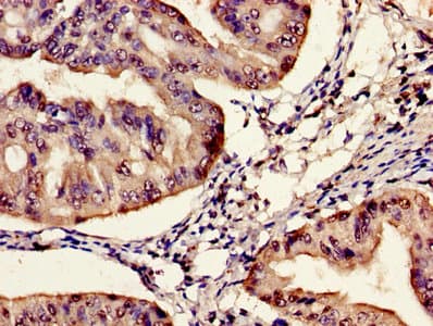 Synaptic nuclei expressed gene 2 (SYNE-2) Antibody