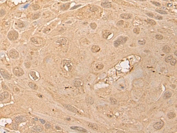 CPNE3 Antibody