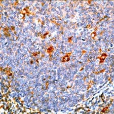 Alpha-1-Antichymotrypsin Antibody