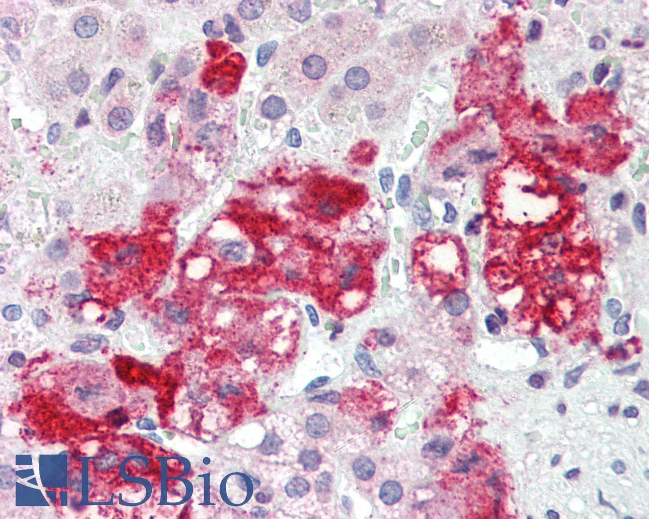 IHC-plus™ Polyclonal Rabbit anti-Human CerS6 / LASS6 Antibody (IHC, IF, WB)