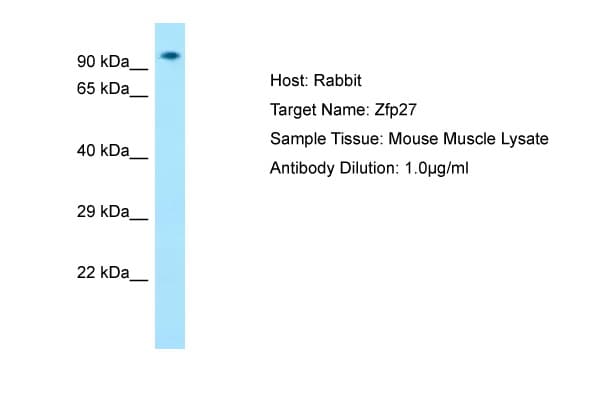 Zfp27 Antibody (aa651-700)