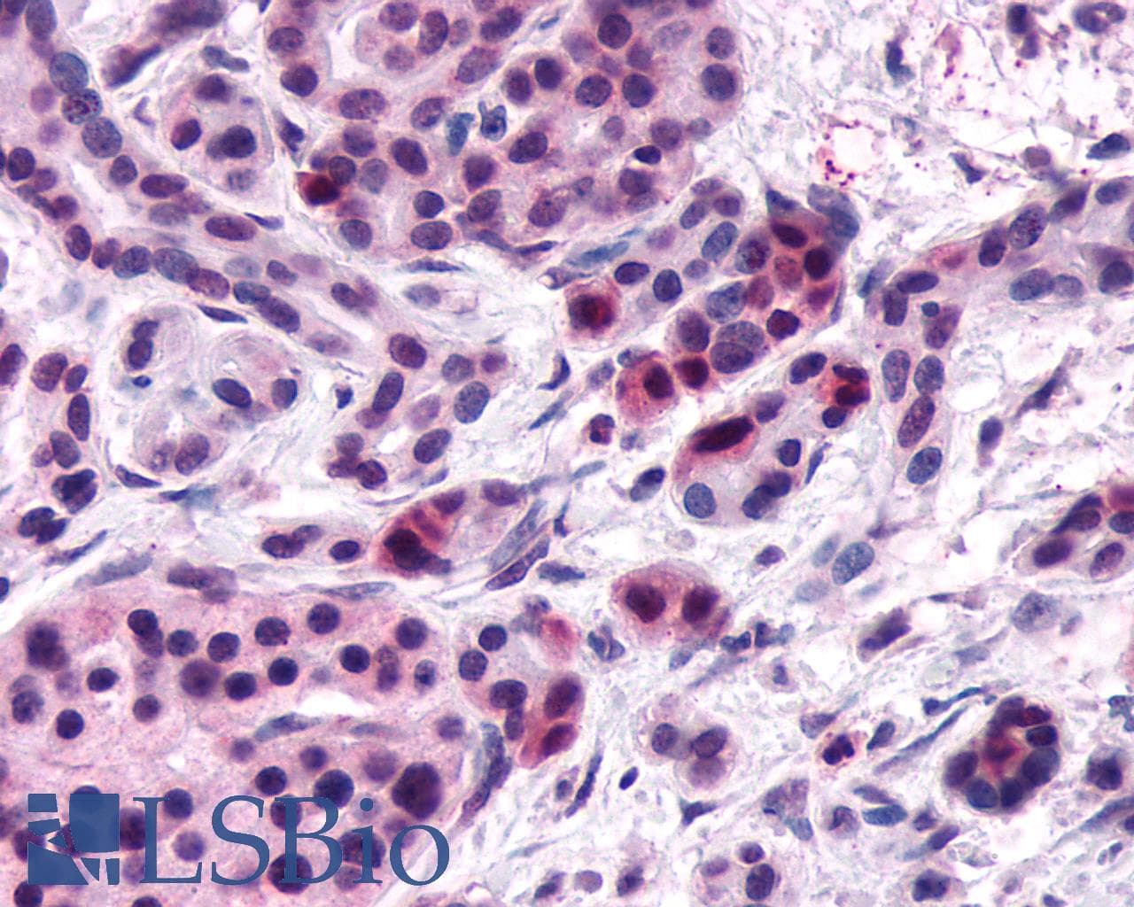 PathPlus™ FZD5 / Frizzled 5 Antibody (N-Terminus)