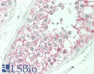 IHC-plus™ Cadherin Antibody (C-Terminus, clone PC-79)