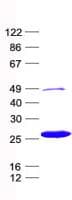 Human ITGB1BP1 / ICAP1 Protein (Recombinant His, N-Terminal)