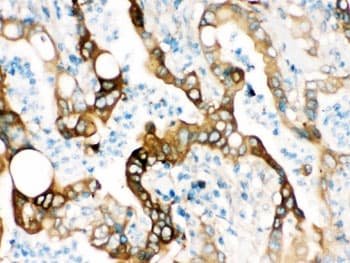 FASN / Fatty Acid Synthase Antibody
