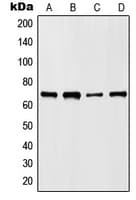 HKR1 Antibody (Internal)
