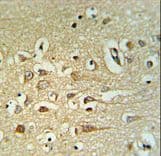 FAM40B Antibody (aa14-41)