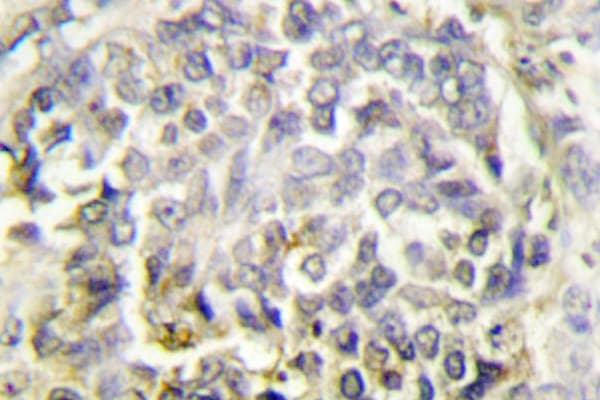 PYCARD / ASC / TMS1 Antibody (Glu13)