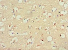 Polyclonal Rabbit anti-Human S100B / S100 Beta Antibody (aa1-92, IHC)