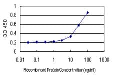 NR0B1 / DAX1 Antibody (clone 2F12)