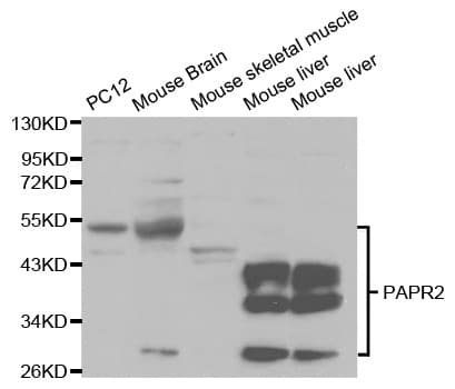 PathPlus™ PARK2 / Parkin 2 Antibody