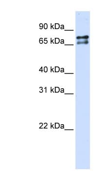 Polyclonal Rabbit anti-Human SF1 Antibody (N-Terminus, WB)
