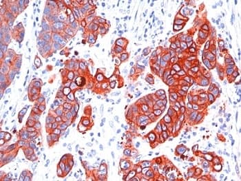 Monoclonal Mouse anti-Human Pan Cytokeratin Antibody (clone SPM583, IHC, IF, WB)