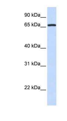 MED26 / CRSP7 Antibody (aa36-85)