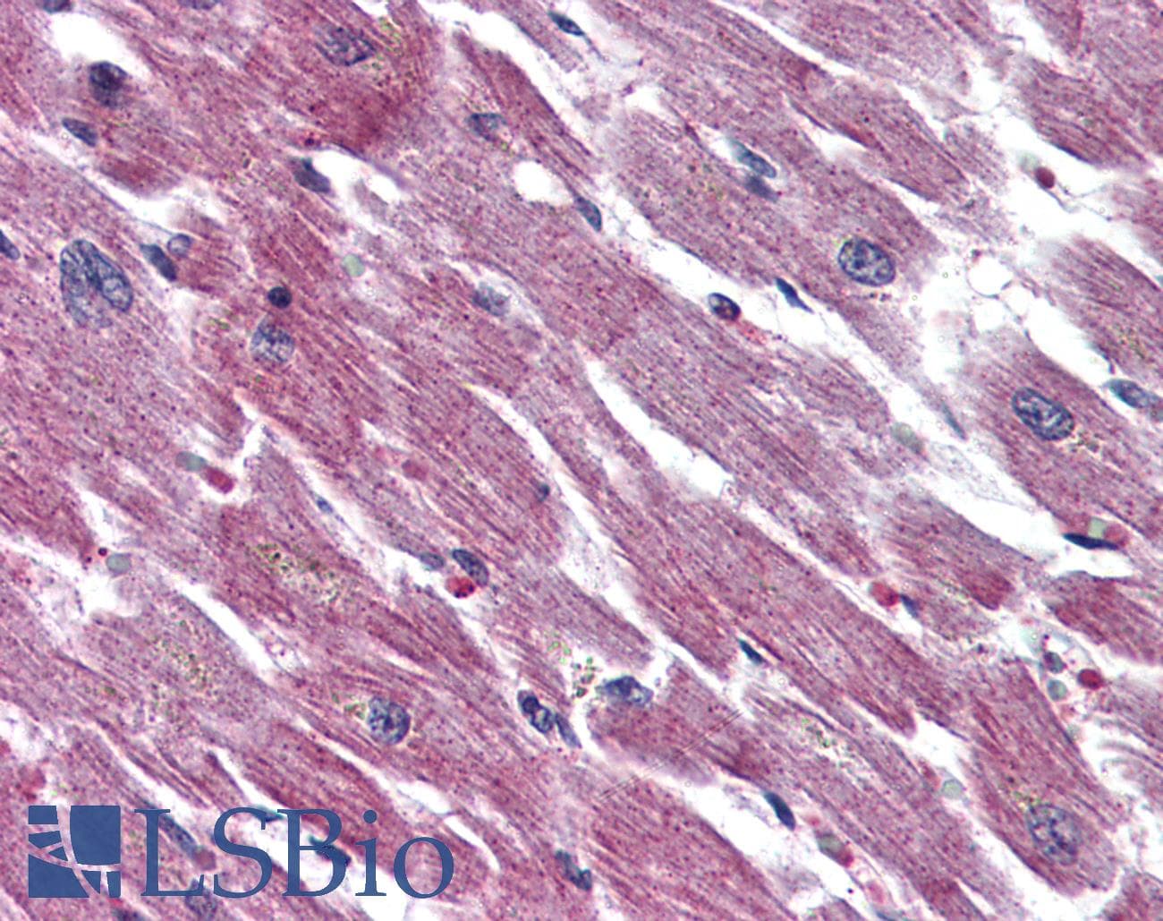 IHC-plus™ ADCYAP1R1 / PAC1 Receptor Antibody (N-Terminus)